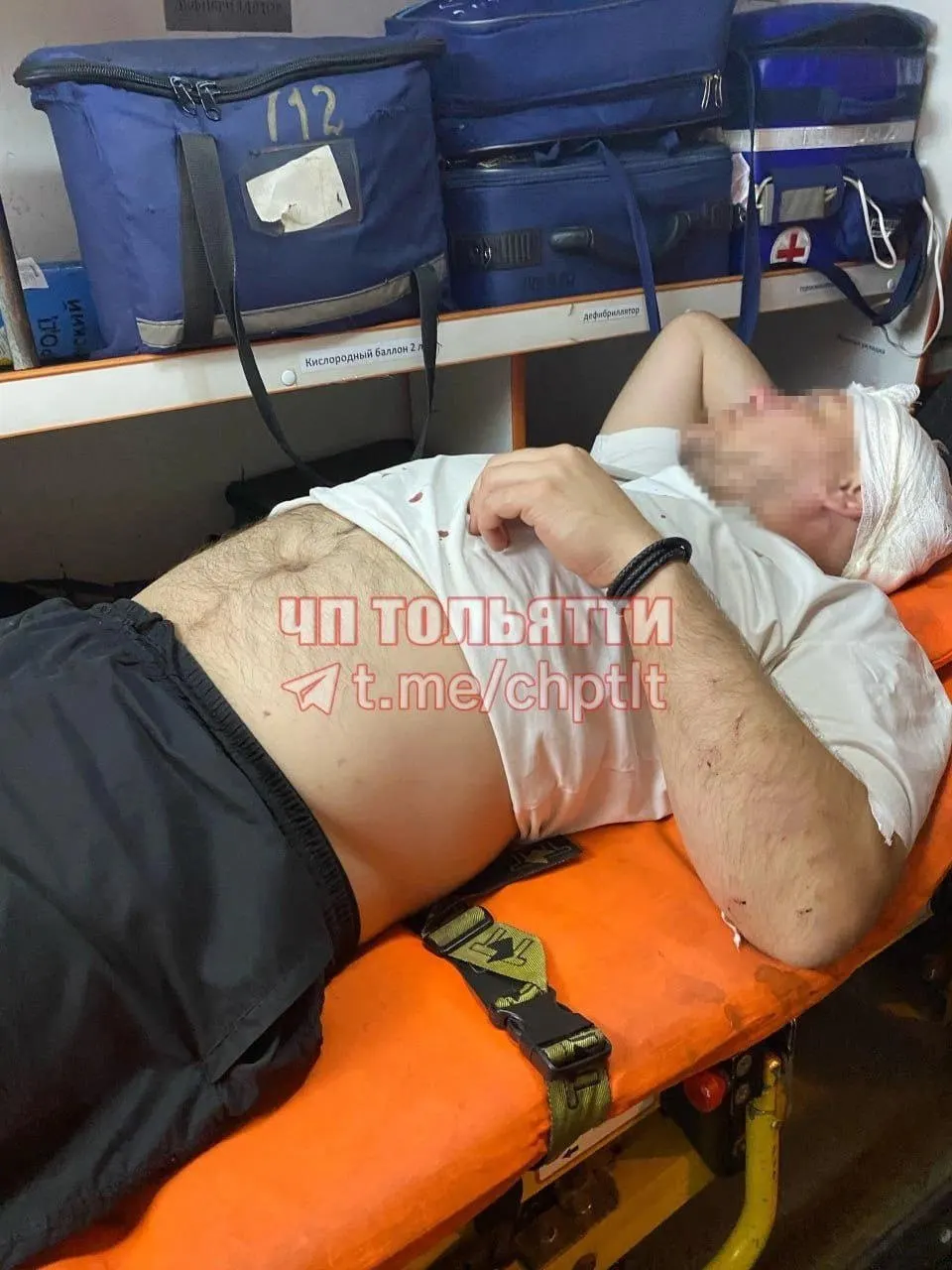 Дорожный конфликт напротив ТЦ «Миндаль»: трое вышли из машины и избили пешехода. Возбуждено уголовное дело по статье «Хулиганство группой лиц».