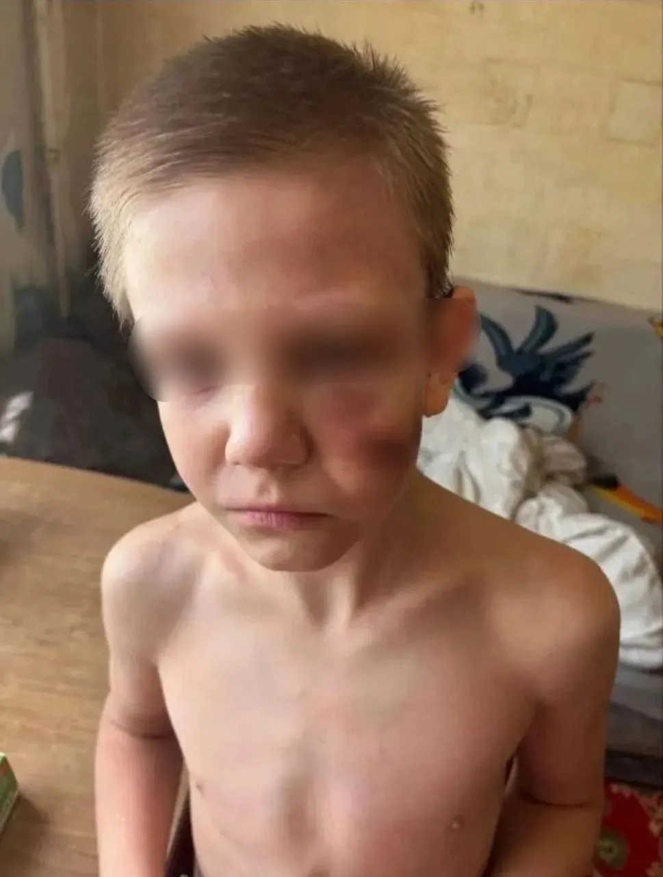 Мальчик в Самаре, по сообщениям активистов, систематически подвергается насилию со стороны отца; соседи слышали крики, а однажды ребенка увезли в травмпункт. Обращения в школу, полицию и органы опеки пока не дали результата.