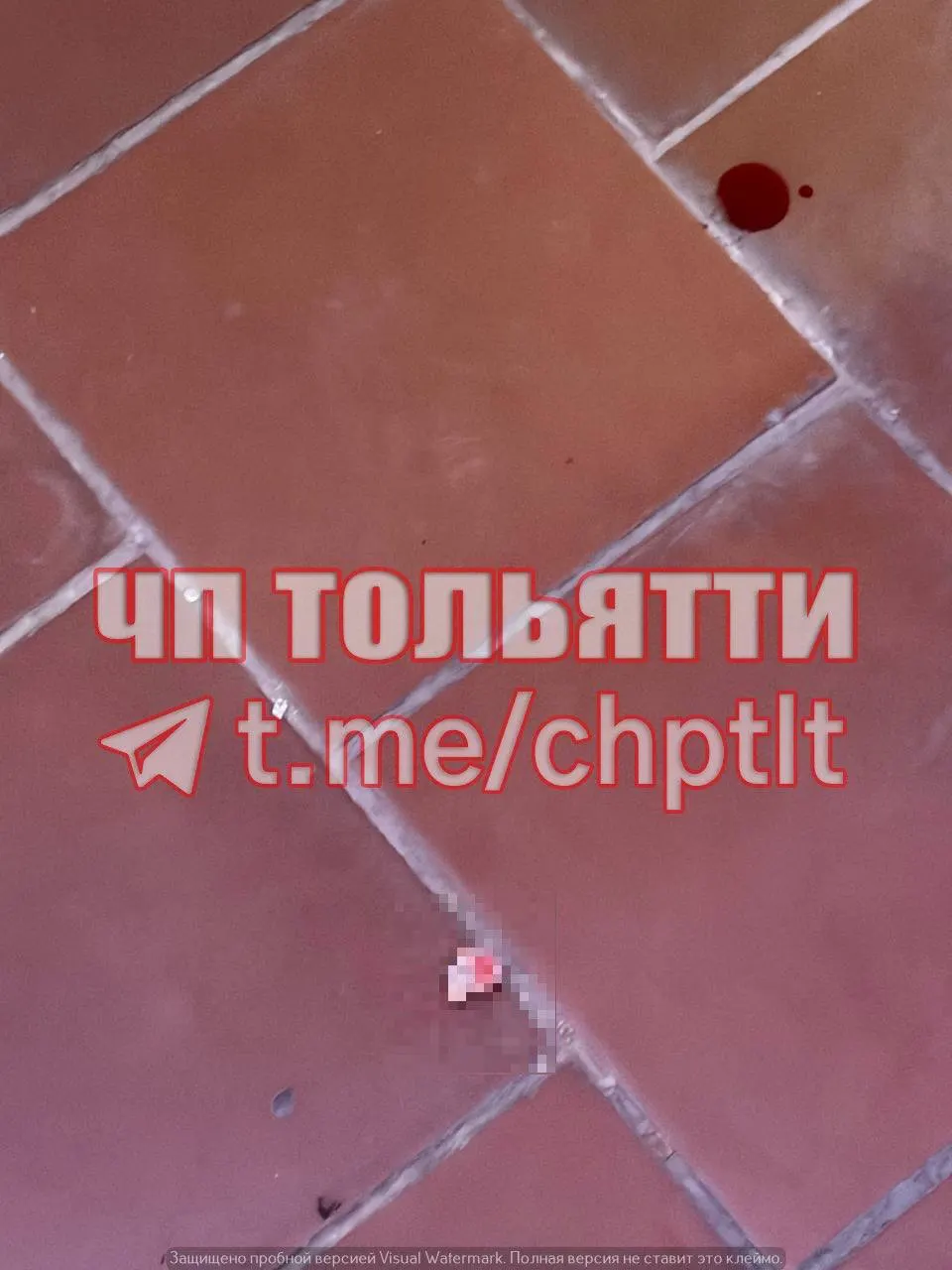 Очевидцы сообщили, что палец девочки зажало дверью.