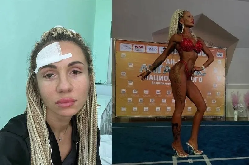 Оксана, работавшая мастером маникюра 13 лет, преодолела химическое отравление и отслойку сетчатки, прошла девять операций и стала призёром соревнований по фитнес-бикини.